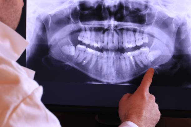Best Emergency Dentist for Knocked-Out Tooth in Martindale, TX